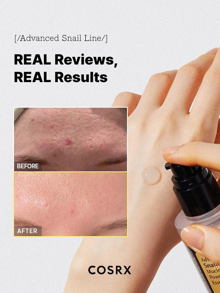 Advanced Snail 96 Mucin Power Essence - HermosoaeCosrx
